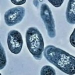 Alerta por E. coli en leche cruda en California