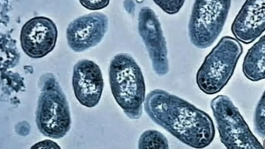 Alerta por E. coli en leche cruda en California