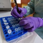 Francia reporta la primera muerte por virus Shamonda