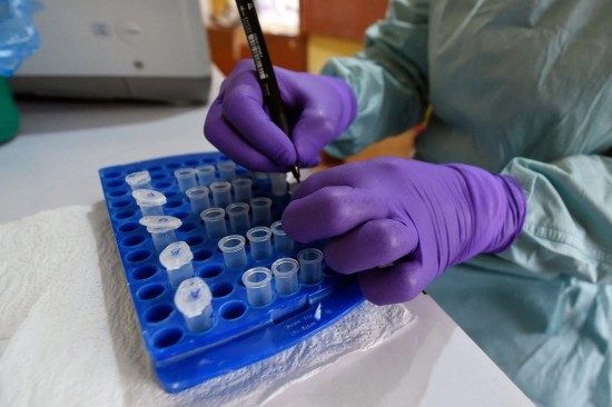 Francia reporta la primera muerte por virus Shamonda